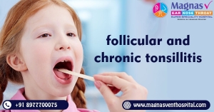 Follicular and chronic tonsillitis treatment in Hyderabad
